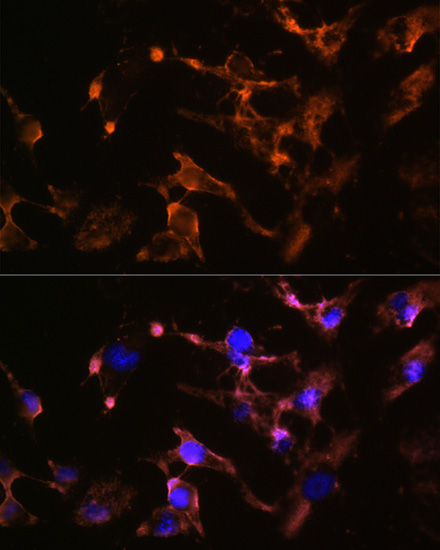 AMPH Rabbit polyclonal antibody
