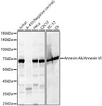 Western blot - Annexin A6/Annexin VI Rabbit pAb (A5390)