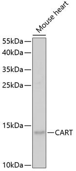 CART Rabbit polyclonal antibody