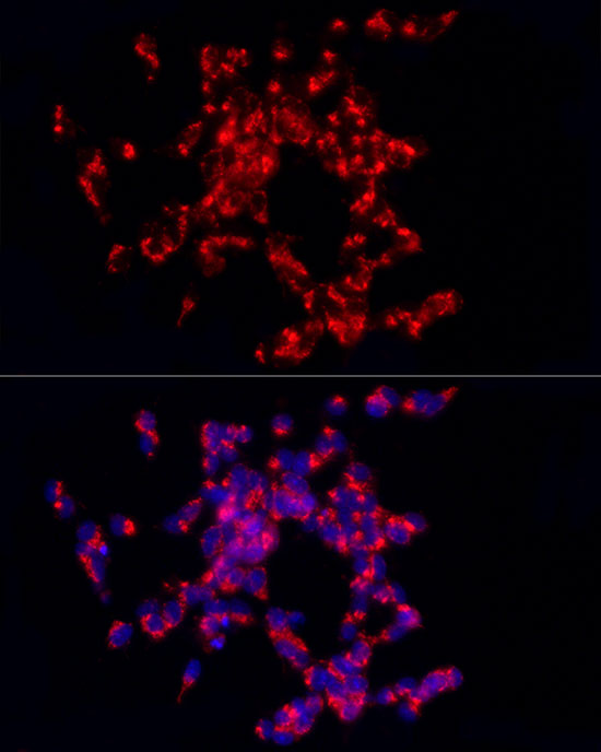 CART Rabbit polyclonal antibody