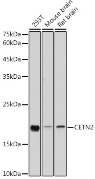 [KO Validated] CETN2 Rabbit pAb