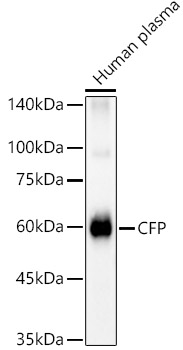 CFP Rabbit polyclonal antibody