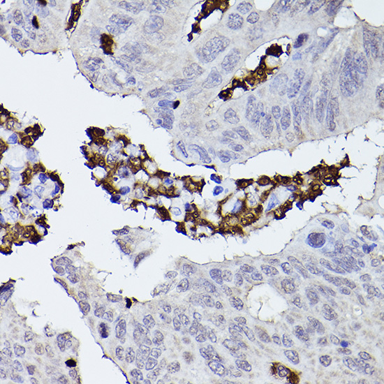 CFP Rabbit polyclonal antibody