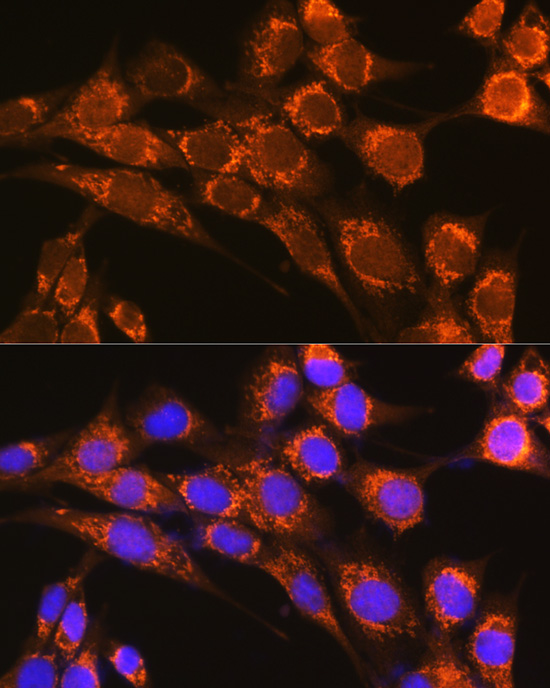 CFP Rabbit polyclonal antibody