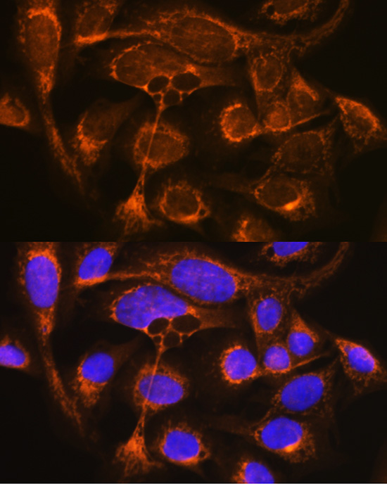 CFP Rabbit polyclonal antibody