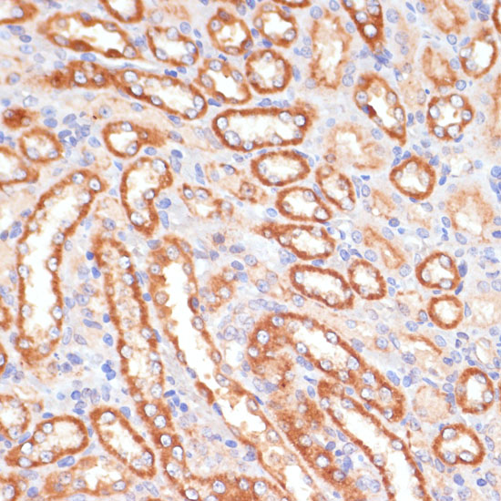 CYB5A Rabbit polyclonal antibody
