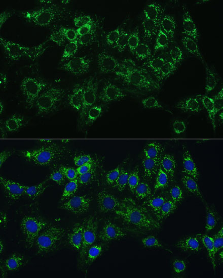 CYB5A Rabbit polyclonal antibody