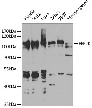 [KO Validated] EEF2K Rabbit polyclonal antibody