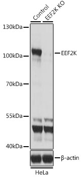 [KO Validated] EEF2K Rabbit polyclonal antibody