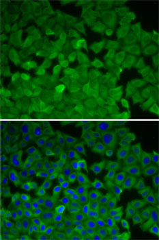 [KO Validated] EEF2K Rabbit polyclonal antibody