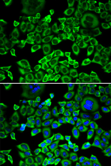 EIF4B Rabbit polyclonal antibody
