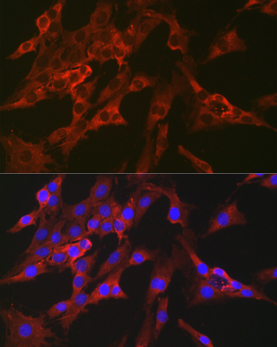 FBP1 Rabbit polyclonal antibody