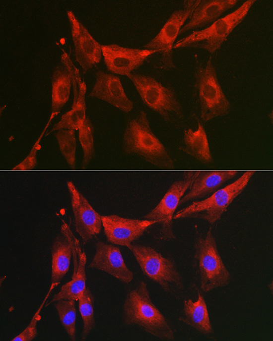 FBP1 Rabbit polyclonal antibody