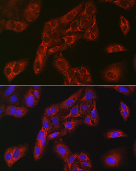 FBP1 Rabbit polyclonal antibody
