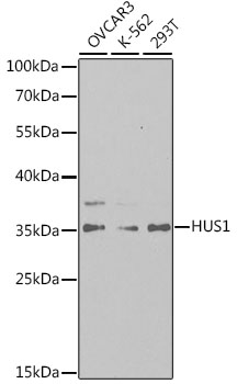 HUS1 Rabbit polyclonal antibody