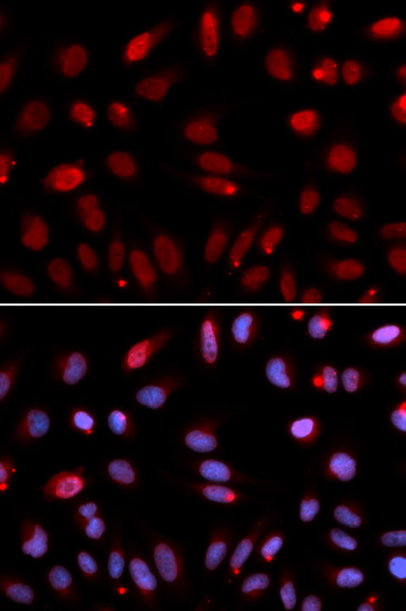 HUS1 Rabbit polyclonal antibody