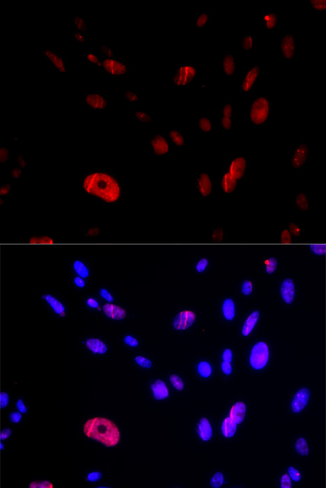 HUS1 Rabbit polyclonal antibody
