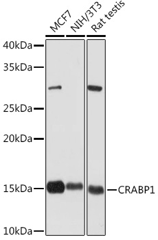 CRABP1 Rabbit monoclonal antibody
