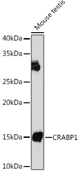 CRABP1 Rabbit monoclonal antibody
