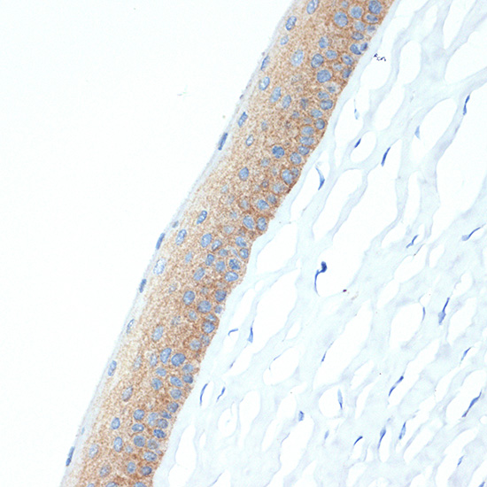 CRABP1 Rabbit monoclonal antibody