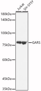 [KO Validated] GARS Rabbit polyclonal antibody