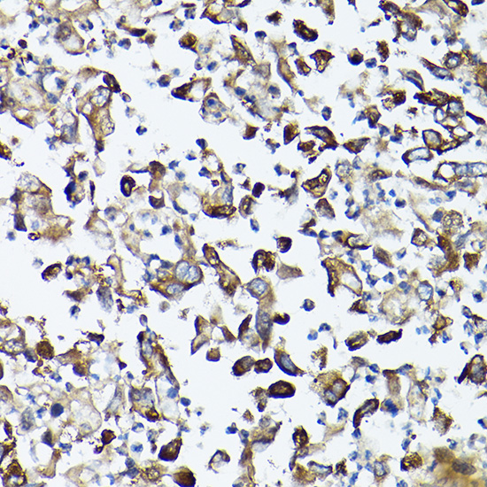 [KO Validated] GARS Rabbit polyclonal antibody