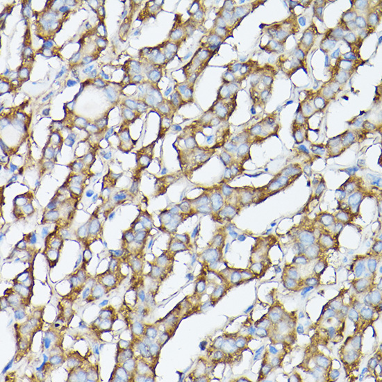 [KO Validated] GARS Rabbit polyclonal antibody