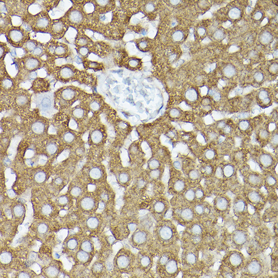 [KO Validated] GARS Rabbit polyclonal antibody