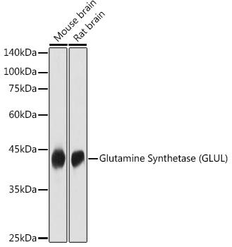 Glutamine Synthetase (GLUL) Rabbit polyclonal antibody