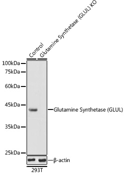 Glutamine Synthetase (GLUL) Rabbit polyclonal antibody