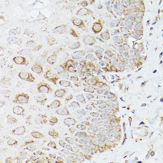Glutamine Synthetase (GLUL) Rabbit polyclonal antibody