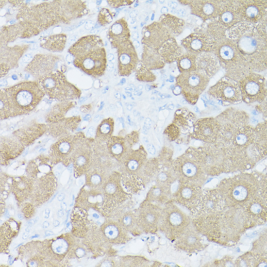 Glutamine Synthetase (GLUL) Rabbit polyclonal antibody