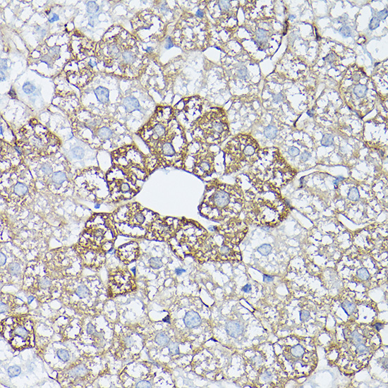 Glutamine Synthetase (GLUL) Rabbit polyclonal antibody