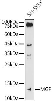 MGP Rabbit polyclonal antibody