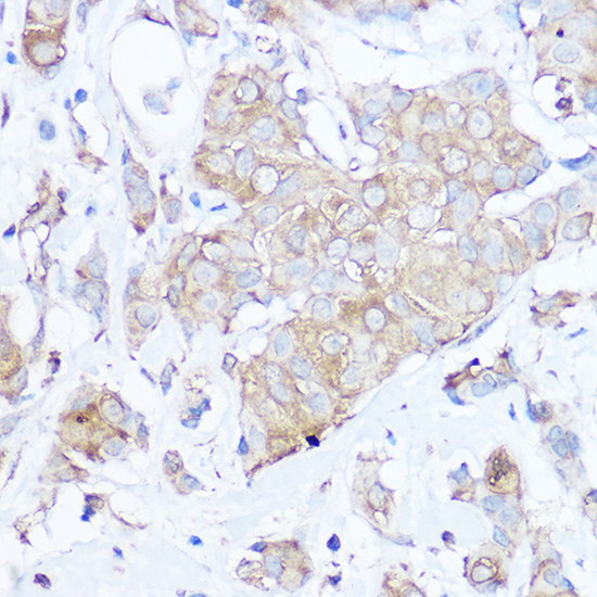 MGP Rabbit polyclonal antibody