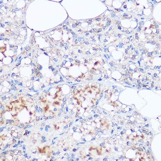 MGP Rabbit polyclonal antibody