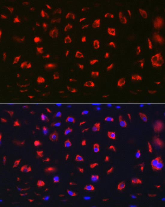 MGP Rabbit polyclonal antibody