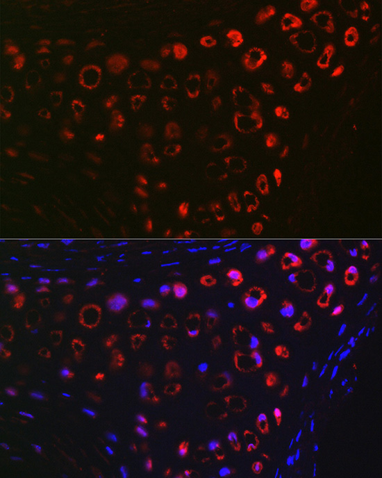 MGP Rabbit polyclonal antibody