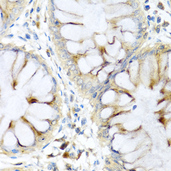 PI3 Rabbit polyclonal antibody