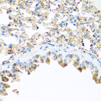 PI3 Rabbit polyclonal antibody