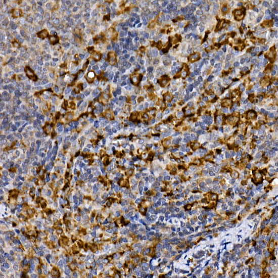 MERTK Rabbit polyclonal antibody