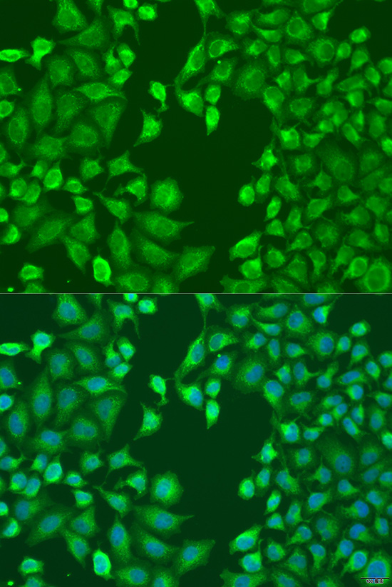 MERTK Rabbit polyclonal antibody