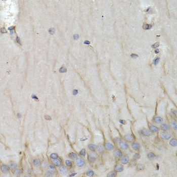 PSMB10 Rabbit polyclonal antibody