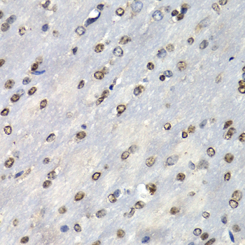 PSMB10 Rabbit polyclonal antibody