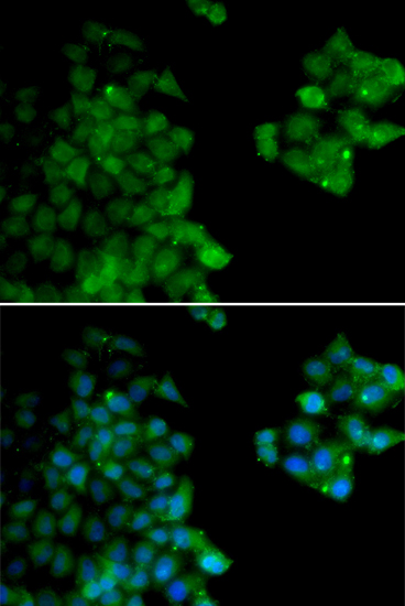 PSMB10 Rabbit polyclonal antibody