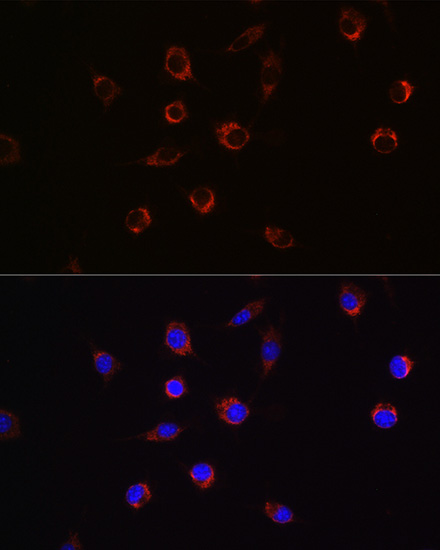 APLP2 Rabbit polyclonal antibody