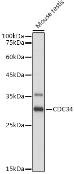 CDC34 Rabbit polyclonal antibody