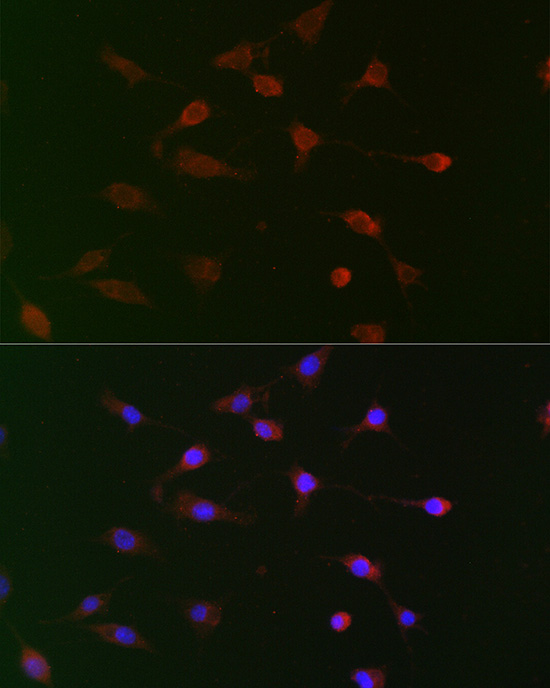 CDC34 Rabbit polyclonal antibody