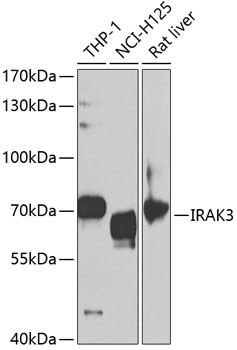 IRAK3 Rabbit polyclonal antibody