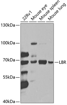 LBR Rabbit polyclonal antibody
